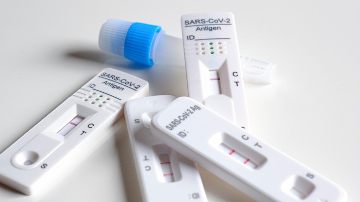 Mehrere SARS-CoV-2-Antigen-Schnelltests und ein blau-weißes Probenröhrchen auf einer hellen Oberfläche. Einige Testkassetten zeigen nur die Kontrolllinie, andere Kontroll- und Testlinie.